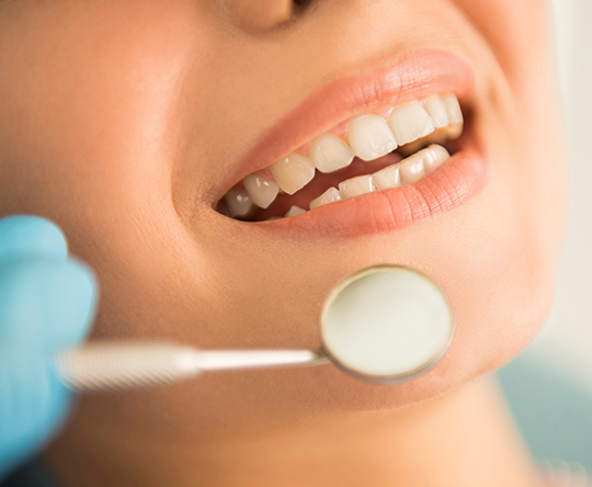 MIG400_Durere de dinți_consultați un stomatolog pentru prevenirea durerii de dinți
